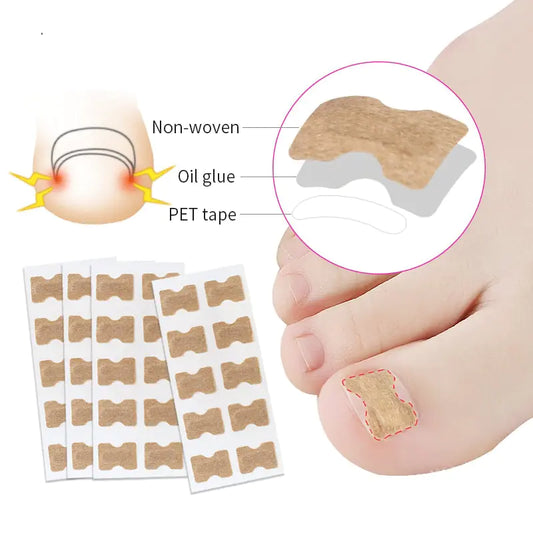 TOE NAIL CORRECTOR, Ingrown Pedicure toe nail care corrector patch provids relief from the pain associated with ingrown toenails and paronychia, designed to protect the bunion, create a barrier between the toe and the shoe, reducing friction and discomfor